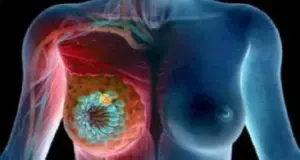 nutriționistul-dietetician alina ciceu