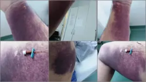 Sechestrat printre morții vii - „jurnalul de a. T. I. ” al unui internat cu covid la cea mai criminală secție a spitalului județean arad 21 ati gradiste