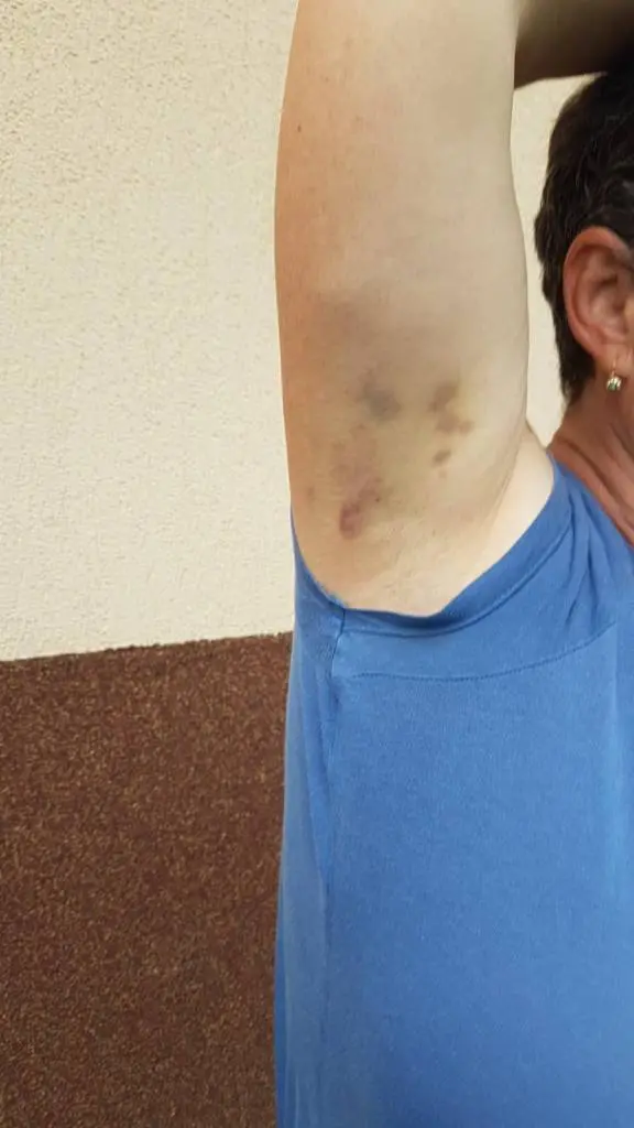 [ACTUALIZARE 2] S-a deschis un DOSAR PENAL vizând agresiunea viceprimarului comunei Hălmăgel, Adrian-Florin Tat, împotriva vecinului său. Din nefericire pentru „bunul mers al Justiției”, de caz se ocupă Secția 10 de Poliție Rurală Gurahonț...