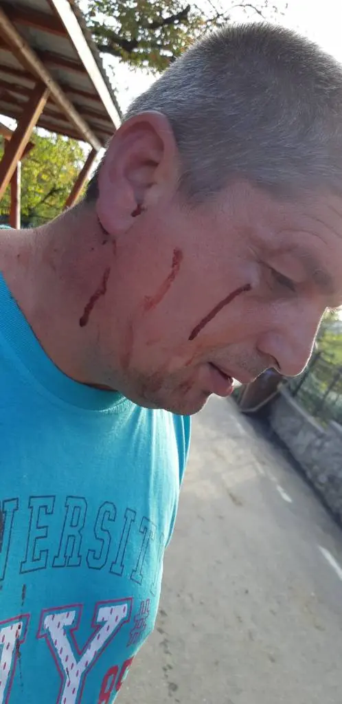 [ACTUALIZARE 2] S-a deschis un DOSAR PENAL vizând agresiunea viceprimarului comunei Hălmăgel, Adrian-Florin Tat, împotriva vecinului său. Din nefericire pentru „bunul mers al Justiției”, de caz se ocupă Secția 10 de Poliție Rurală Gurahonț...