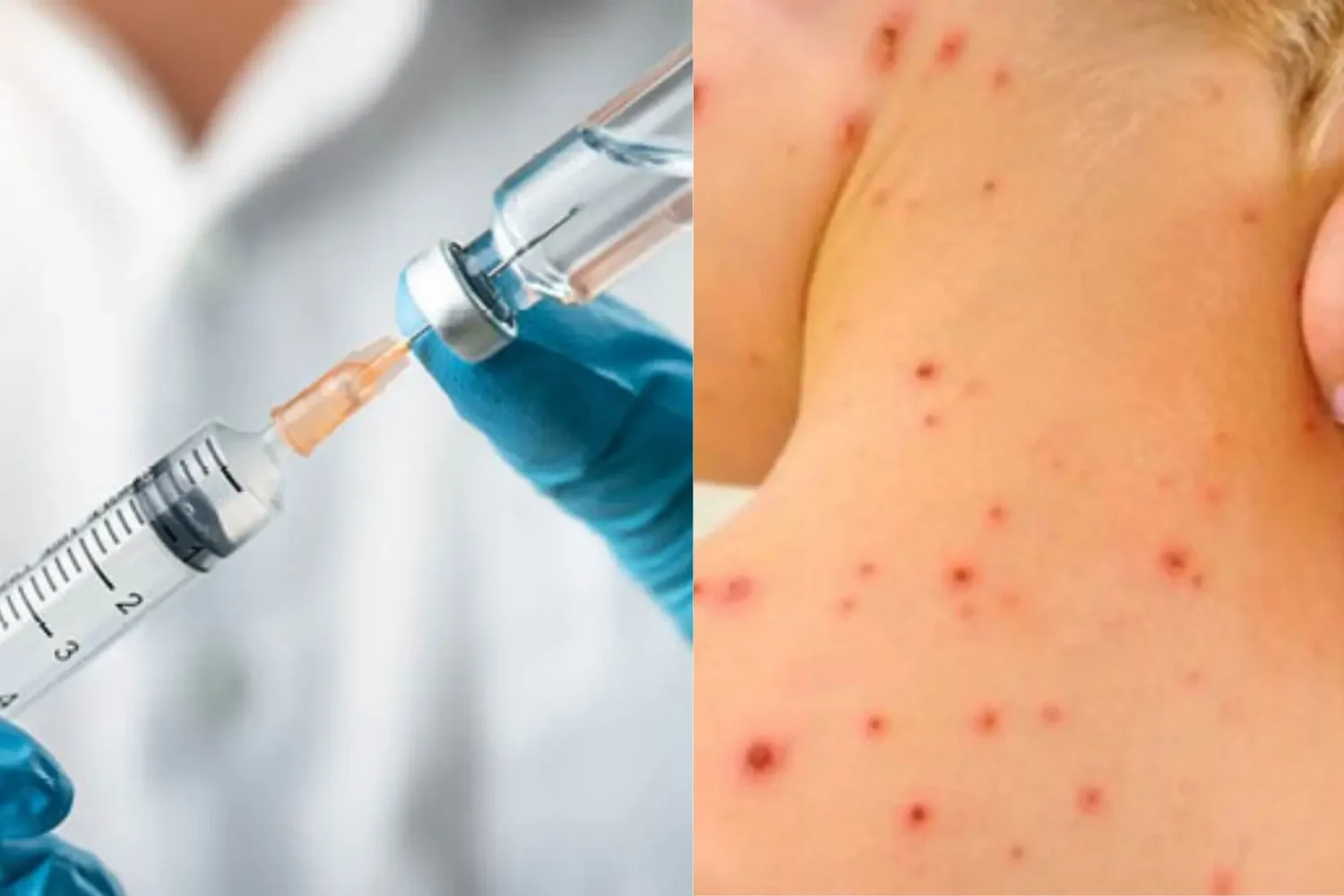 ministerul sănătății a declarat epidemie