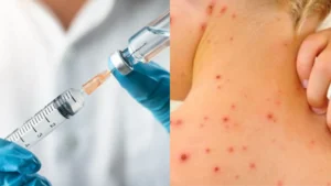 ministerul sănătății a declarat epidemie