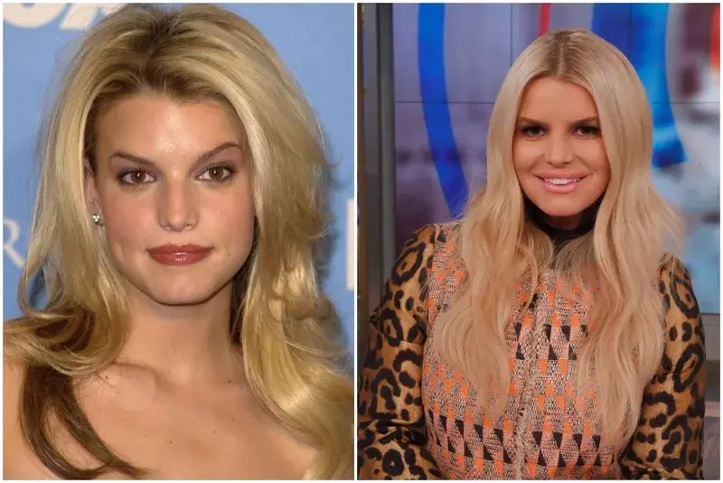 JESSICA SIMPSON Celeb Plastic Surgeries That Cost An Arm and A Leg 2.jpg.pro cmg