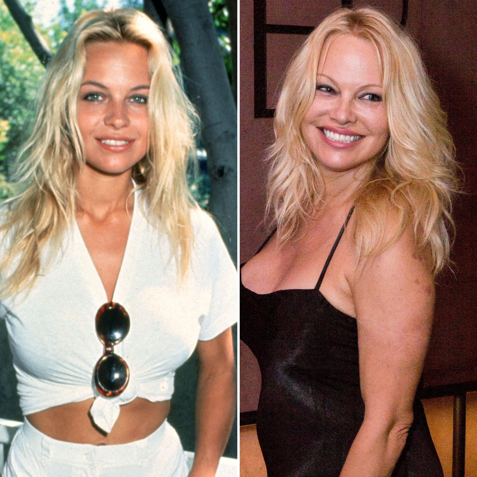 pamela anderson plastic surgery new february 2022 scaled