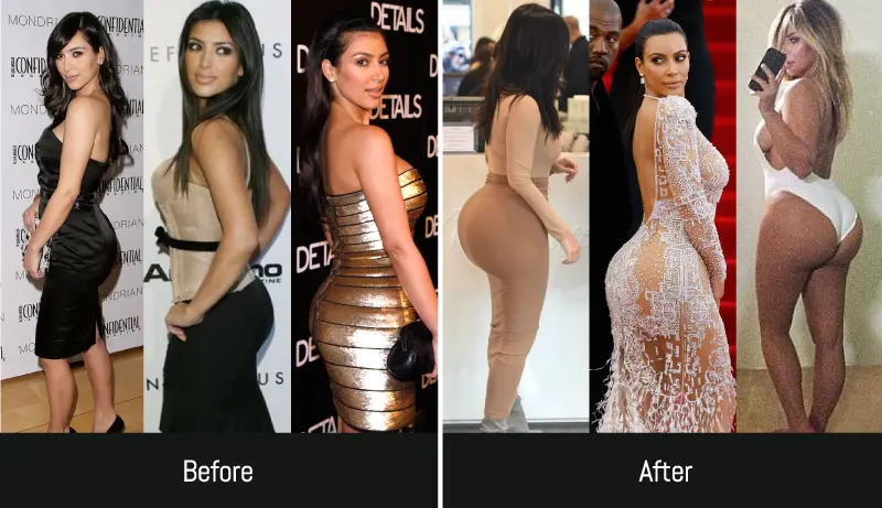 kimk