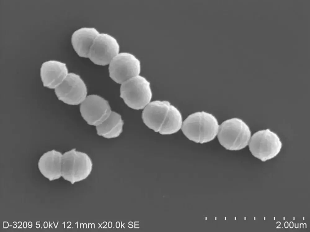 Bacterie rară care distruge țesuturile se răspândește rapid în japonia 3 bacterie