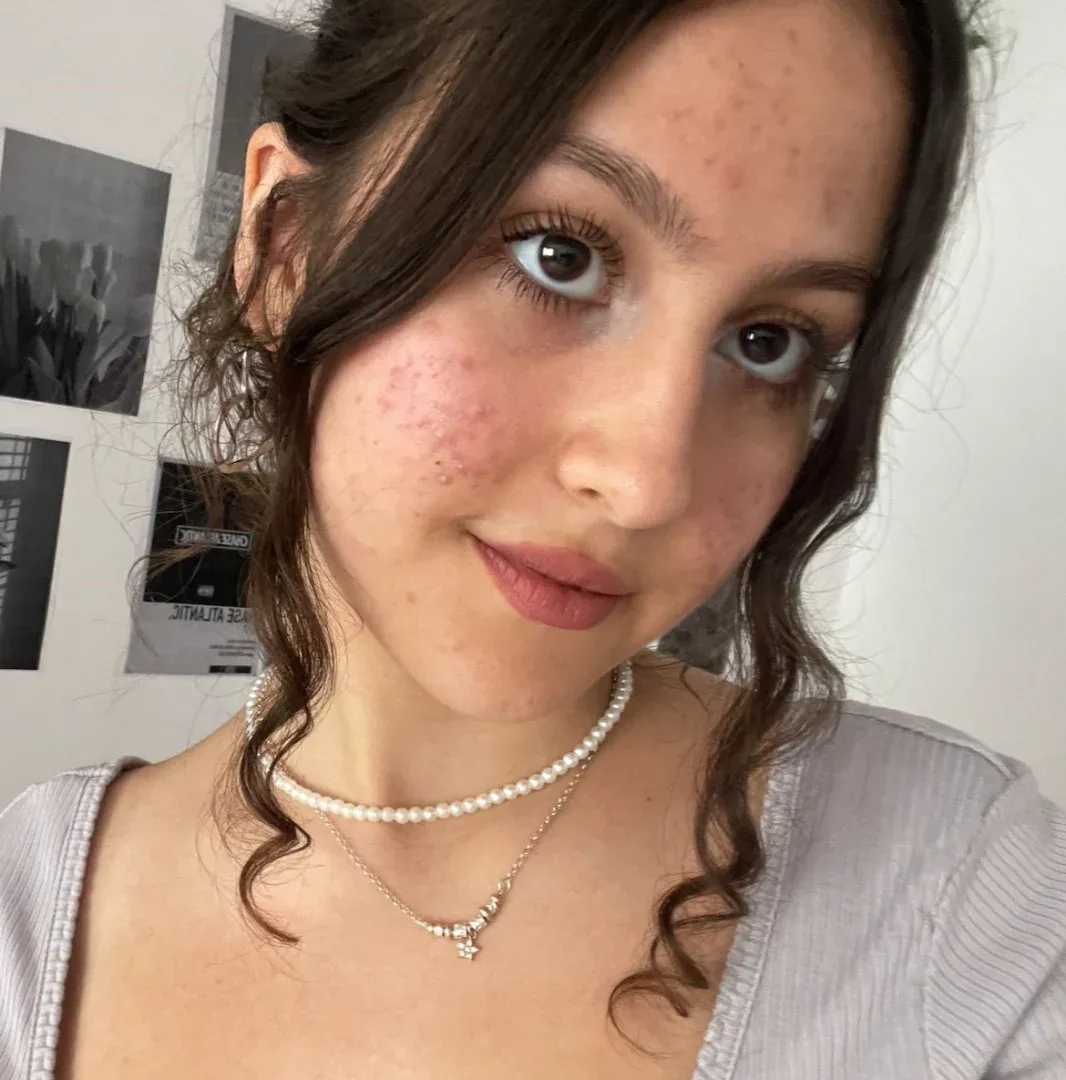 alis