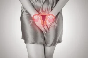 endometrioza