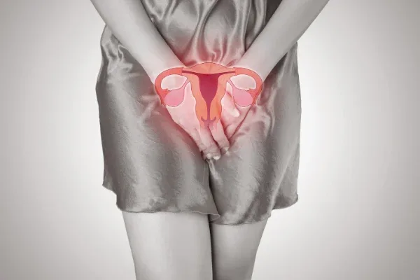 endometrioza